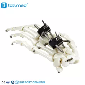 Mini Fixator Straight Type