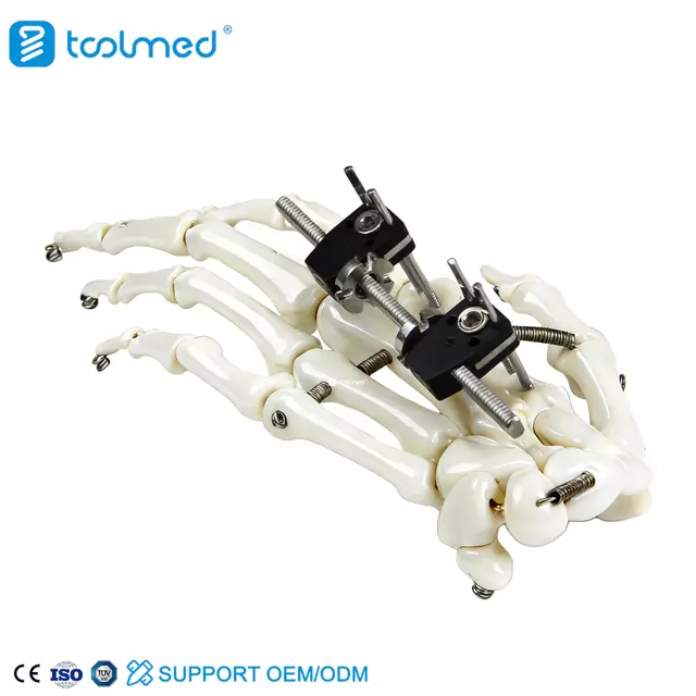 Mini Fixator Straight Type