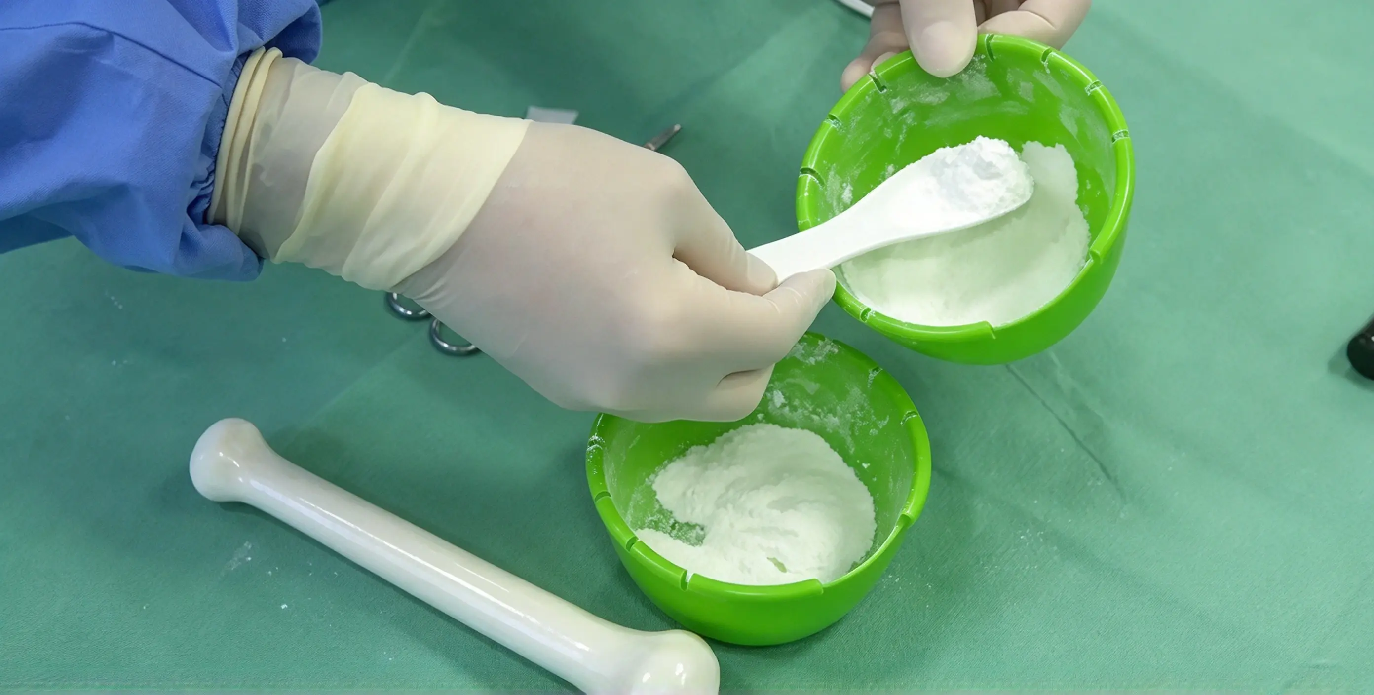 bone cement 1