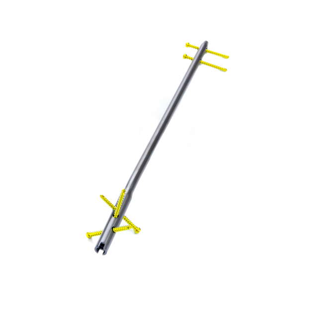 Humeral Intramedullary Nail