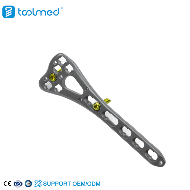 VA Distal Radius Locking Plate 22mm