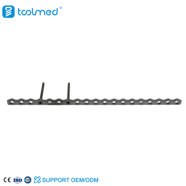 ALPS Reconstruction Locking Plate System (Titanium) - Head Lock Type
