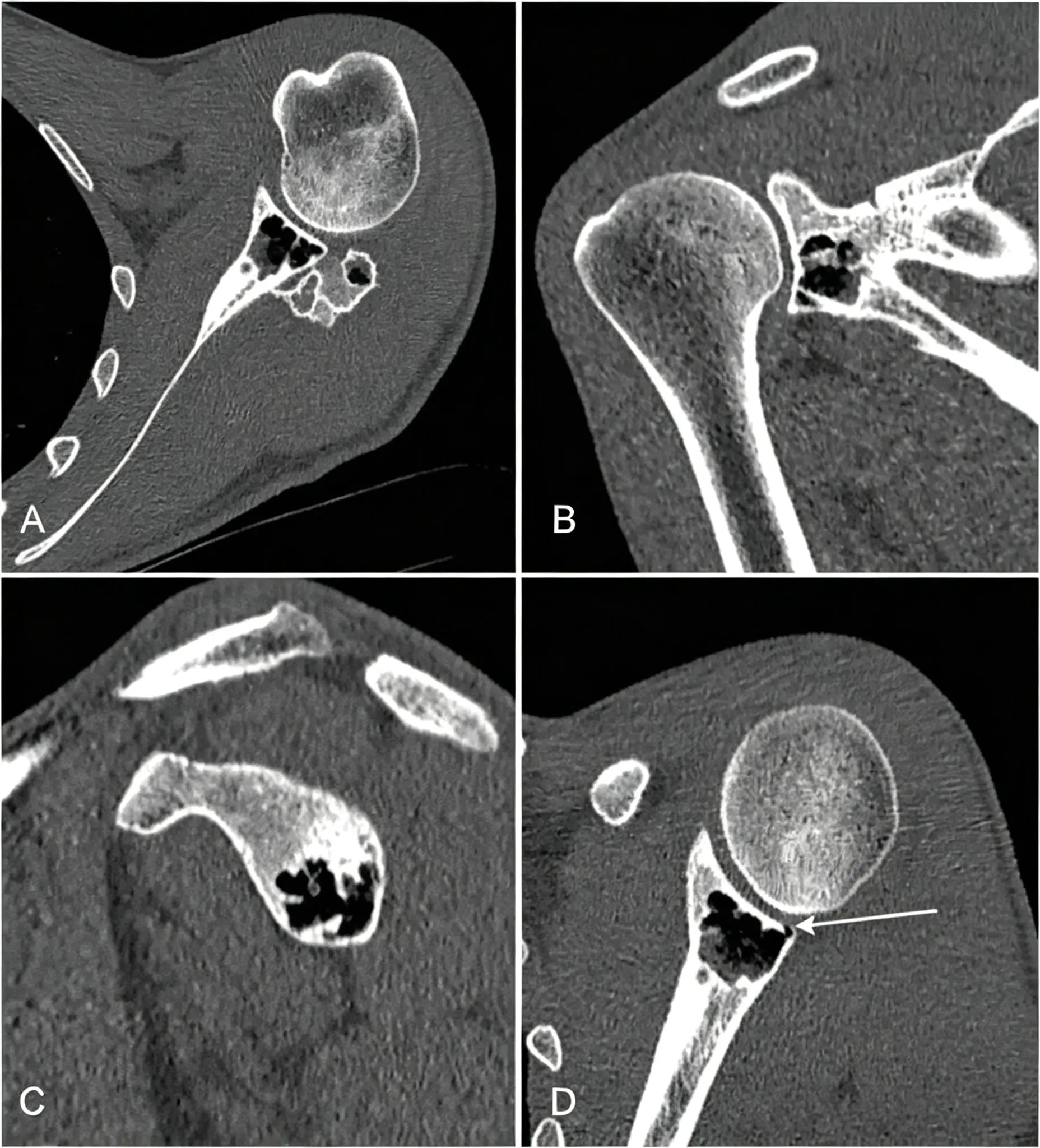 Contrast-enhanced CT examination.webp