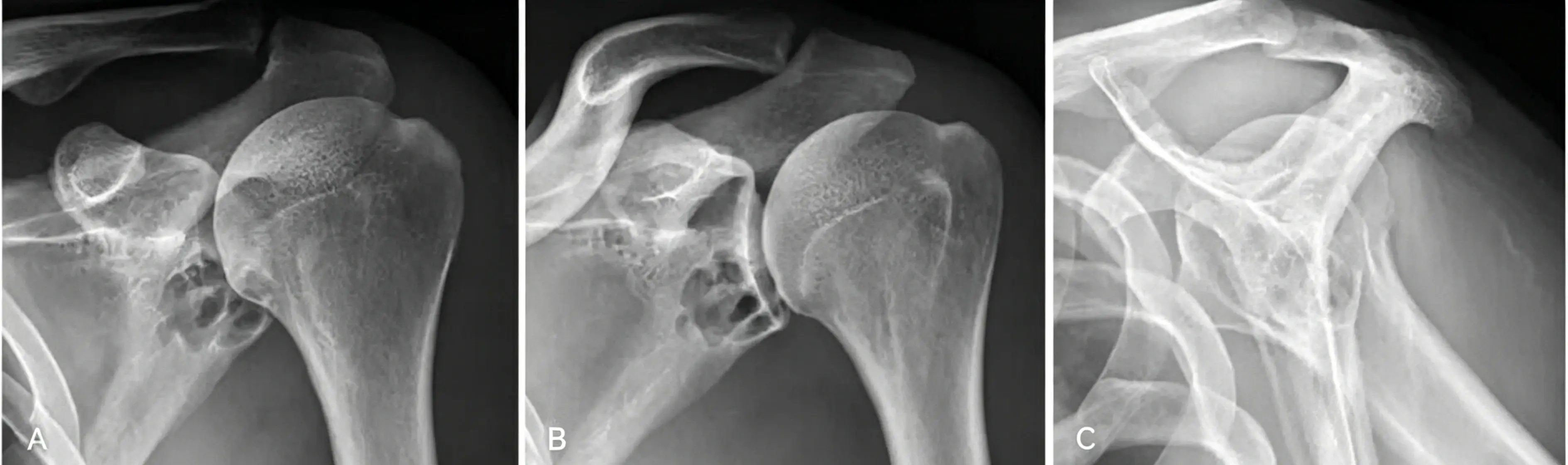 X-ray examination.webp