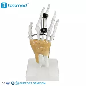 Mini Fragment External Fixator (Finger and Palm) 5100-0103