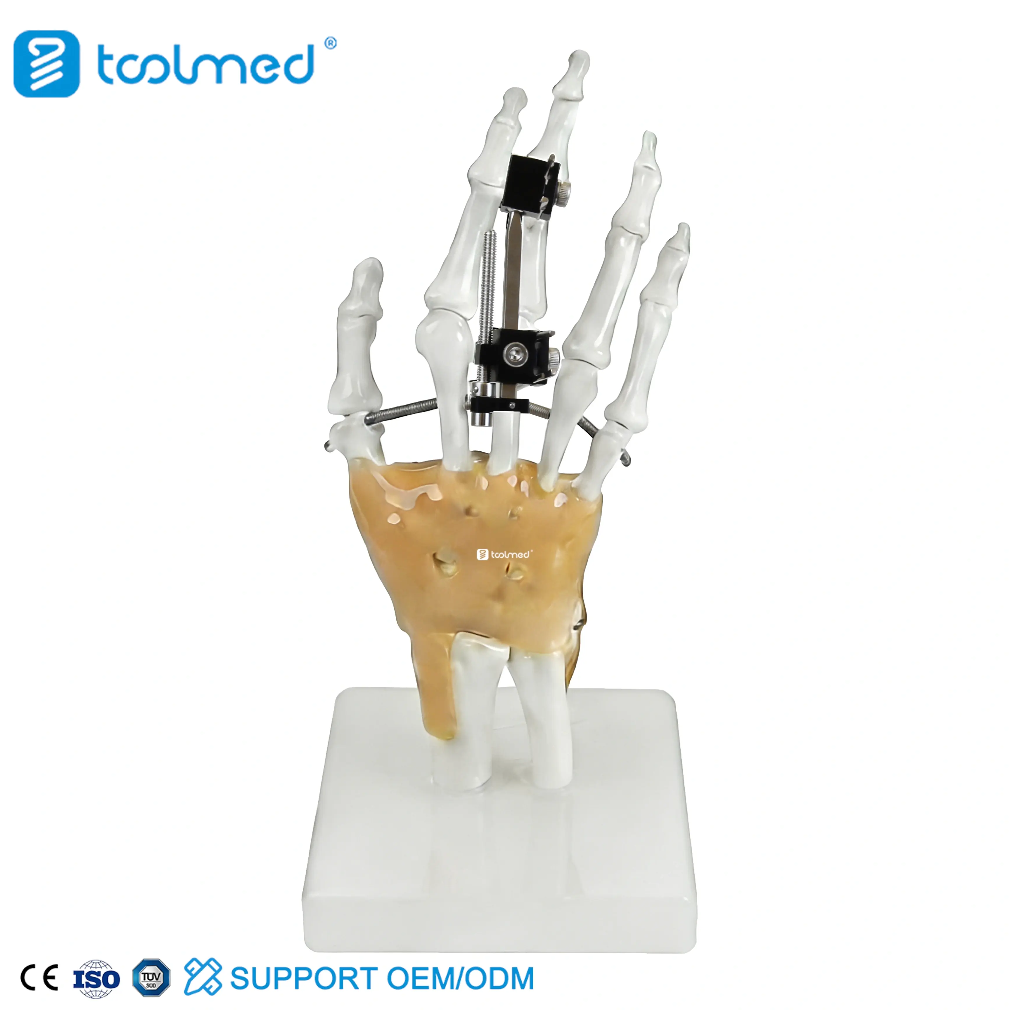 Mini Fragment External Fixator (Finger and Palm) 5100-0103