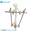 Humeral Shaft External Fixator 5300-10