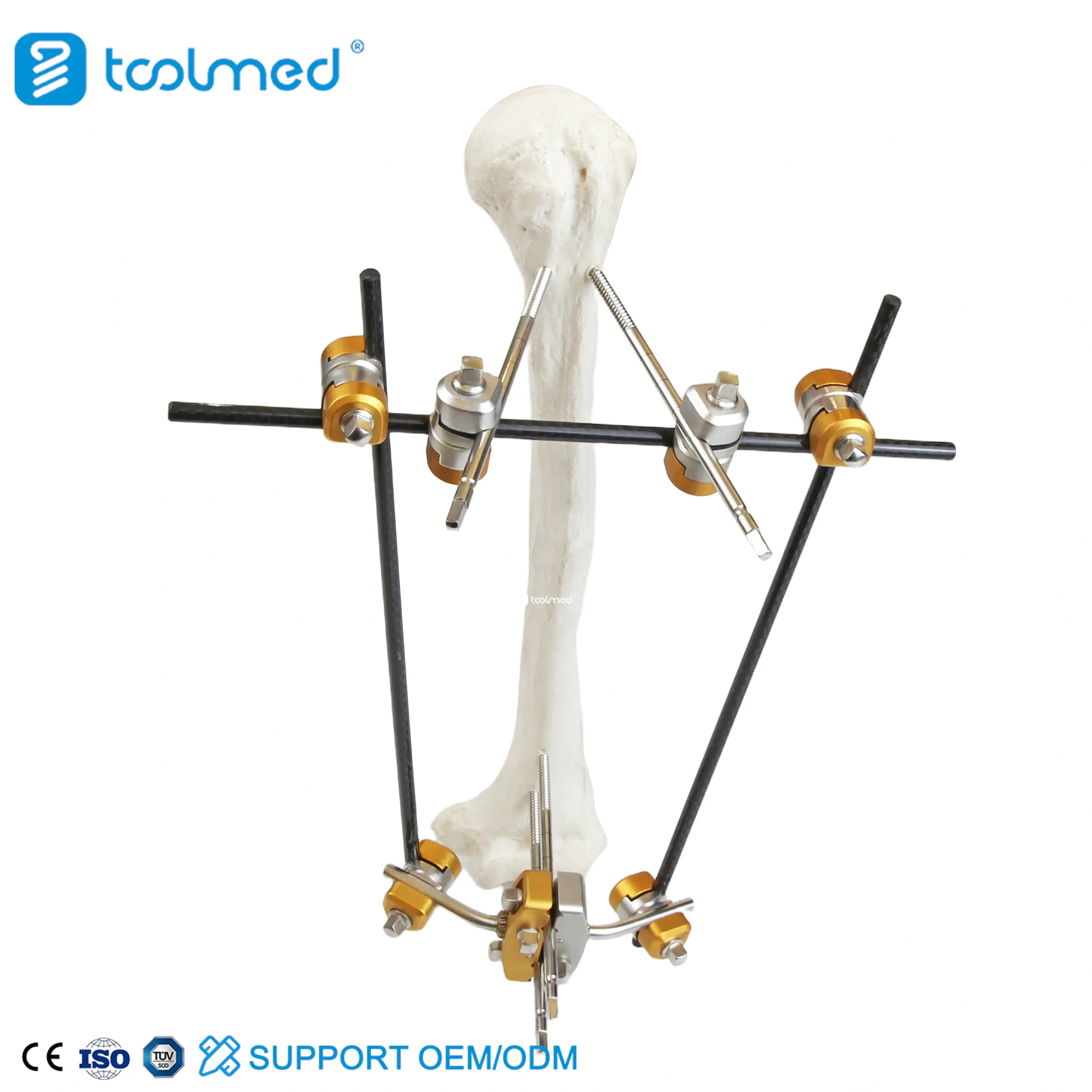 Humeral Shaft External Fixator 5300-10
