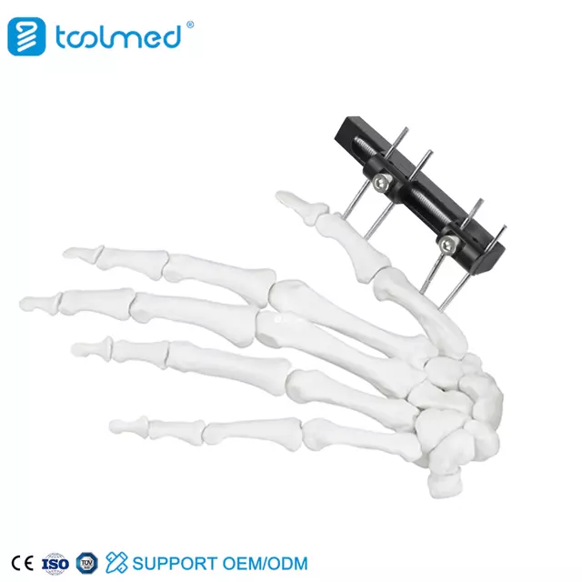 Mini Fixator Straight Track Type
