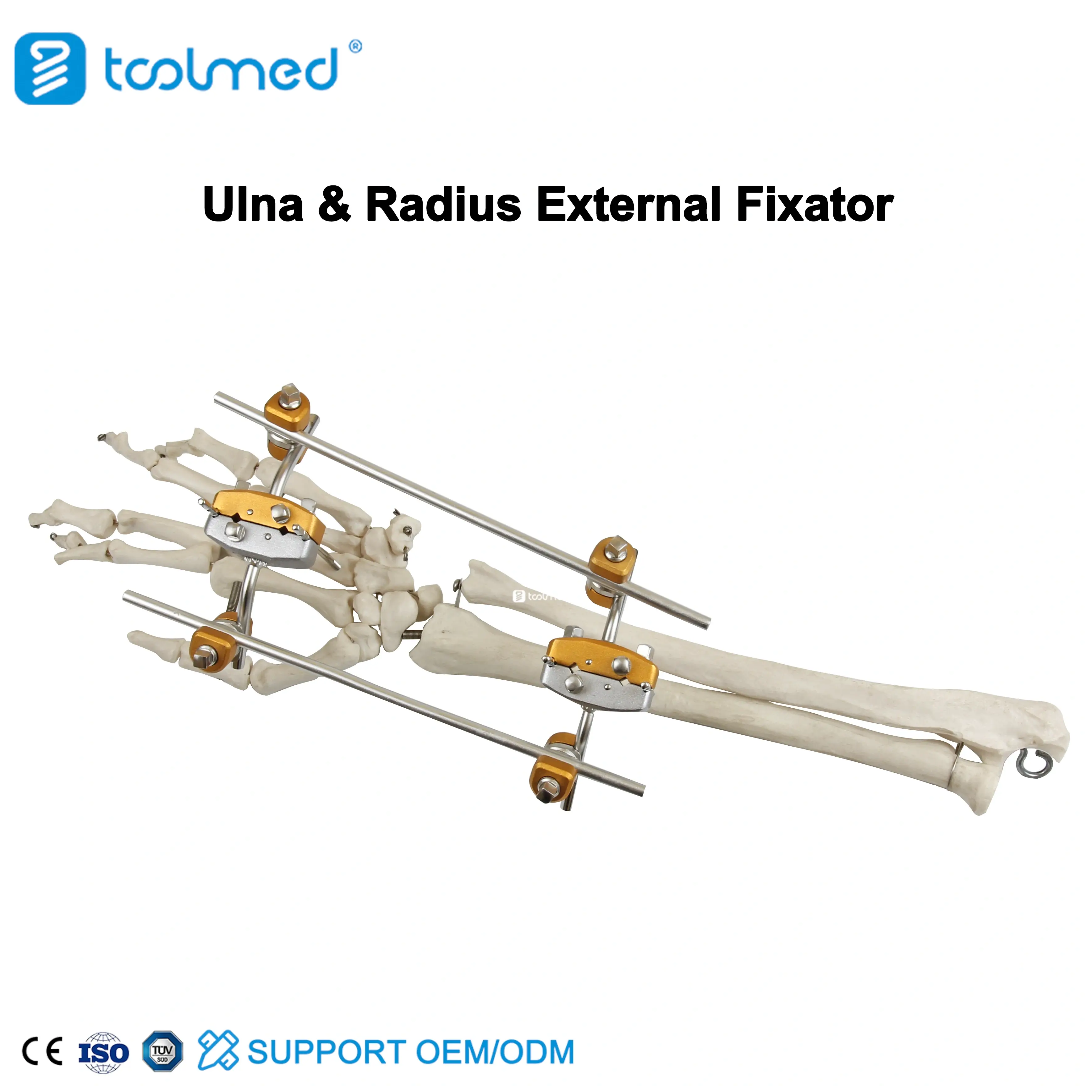 Ulna & Radius External Fixator