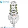 EVEREST 5.5 MIS Polyaxial Pedicle Screw