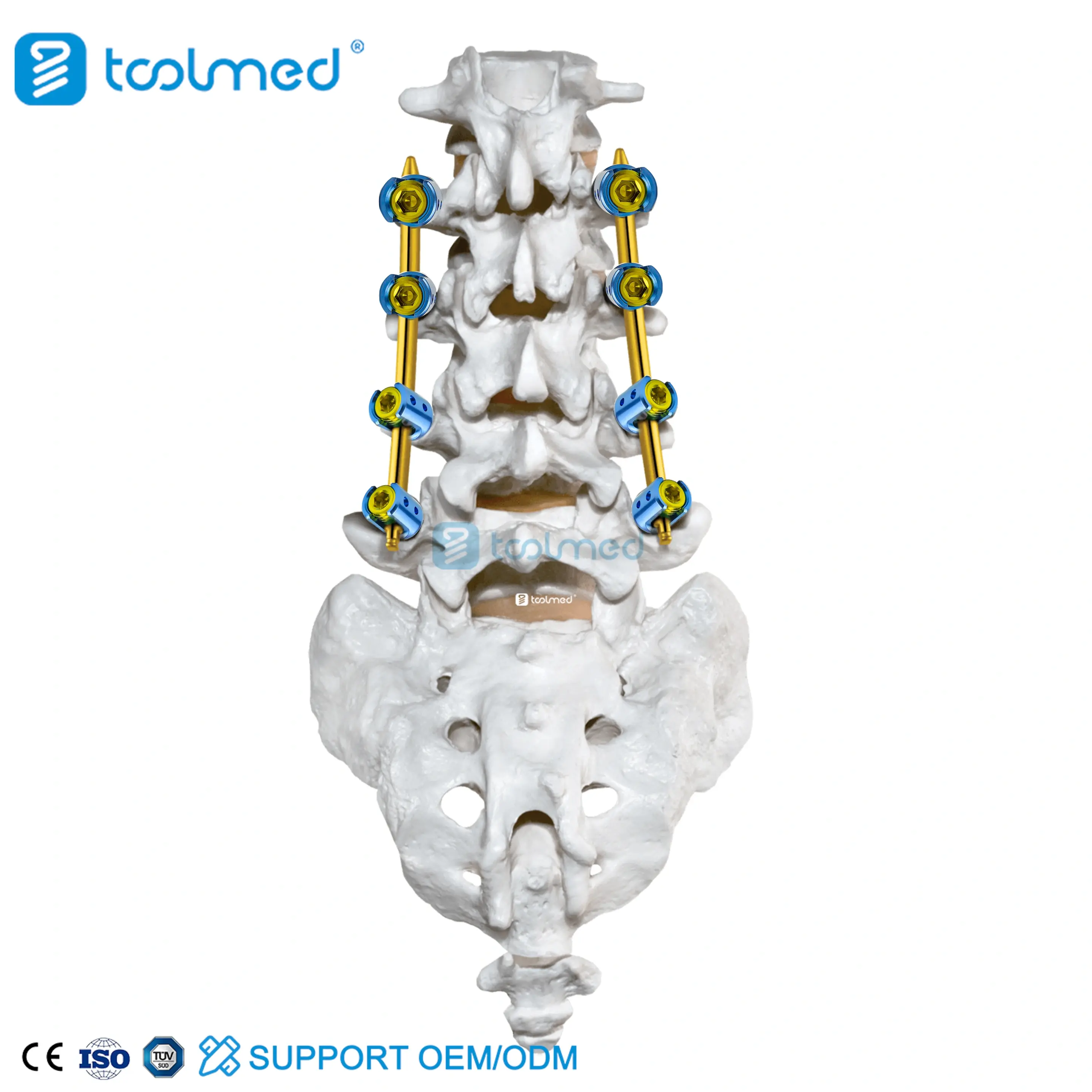EVEREST 5.5 MIS Polyaxial Pedicle Screw
