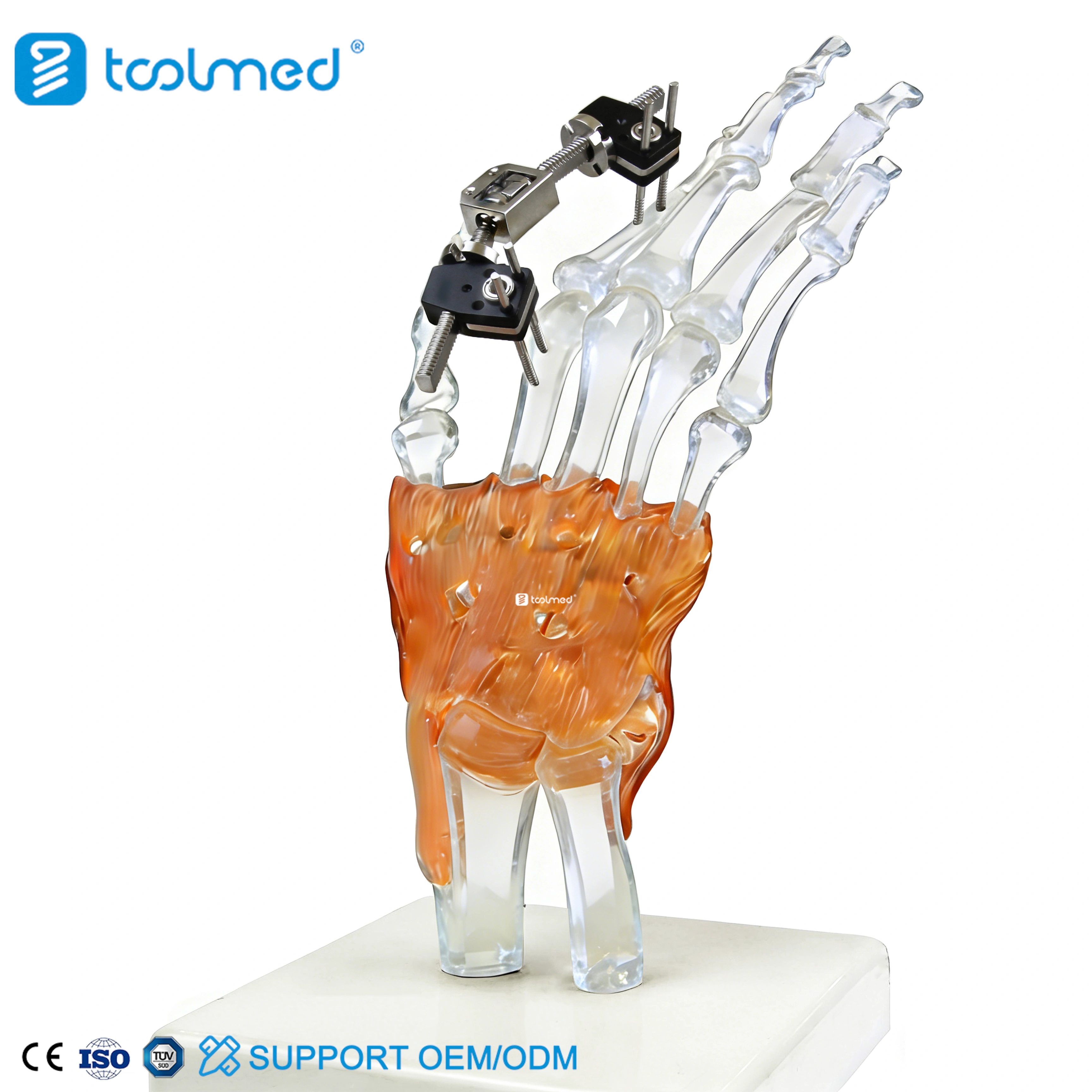 Mini Fixator Joint Motion Type