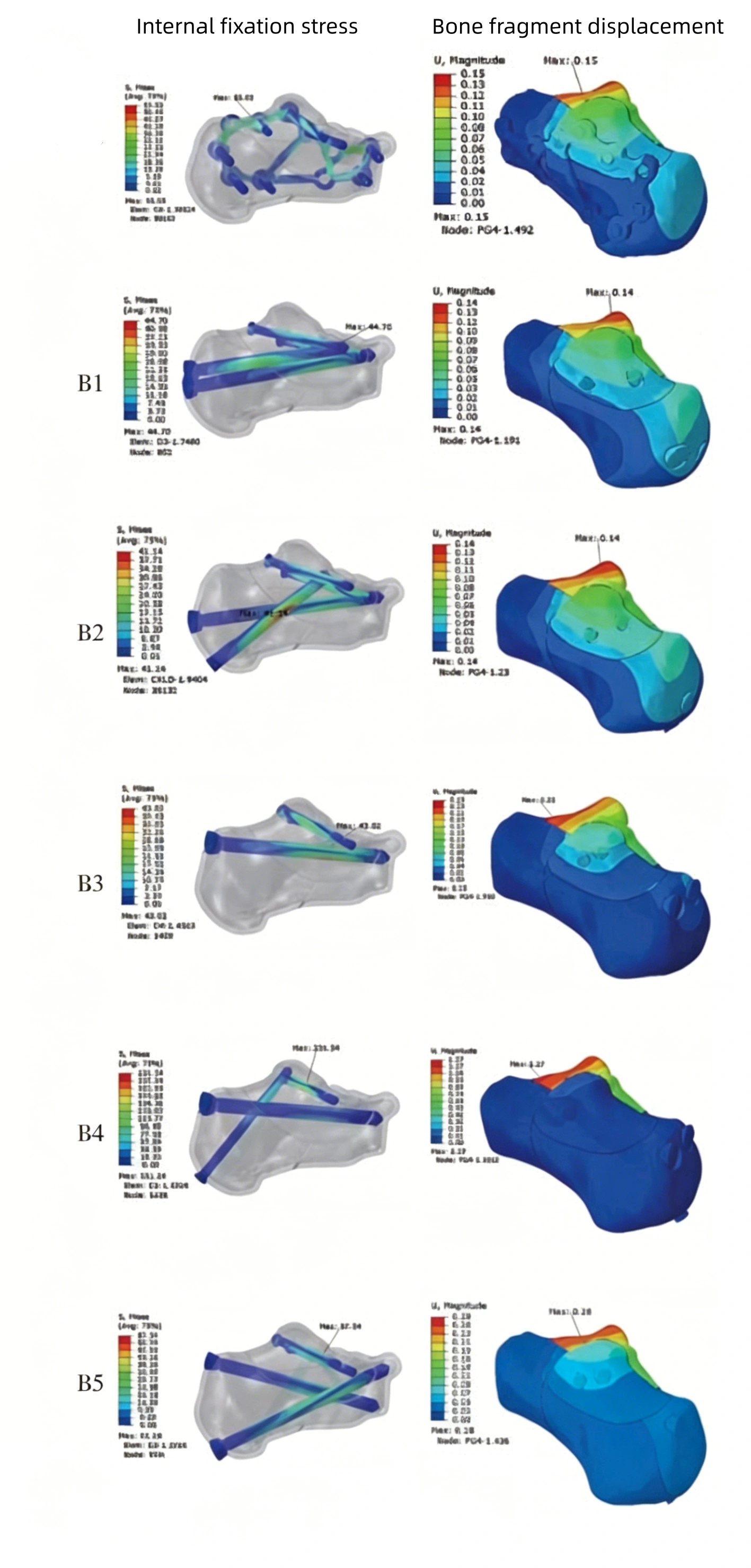 Tongue-type fracture model 4.webp