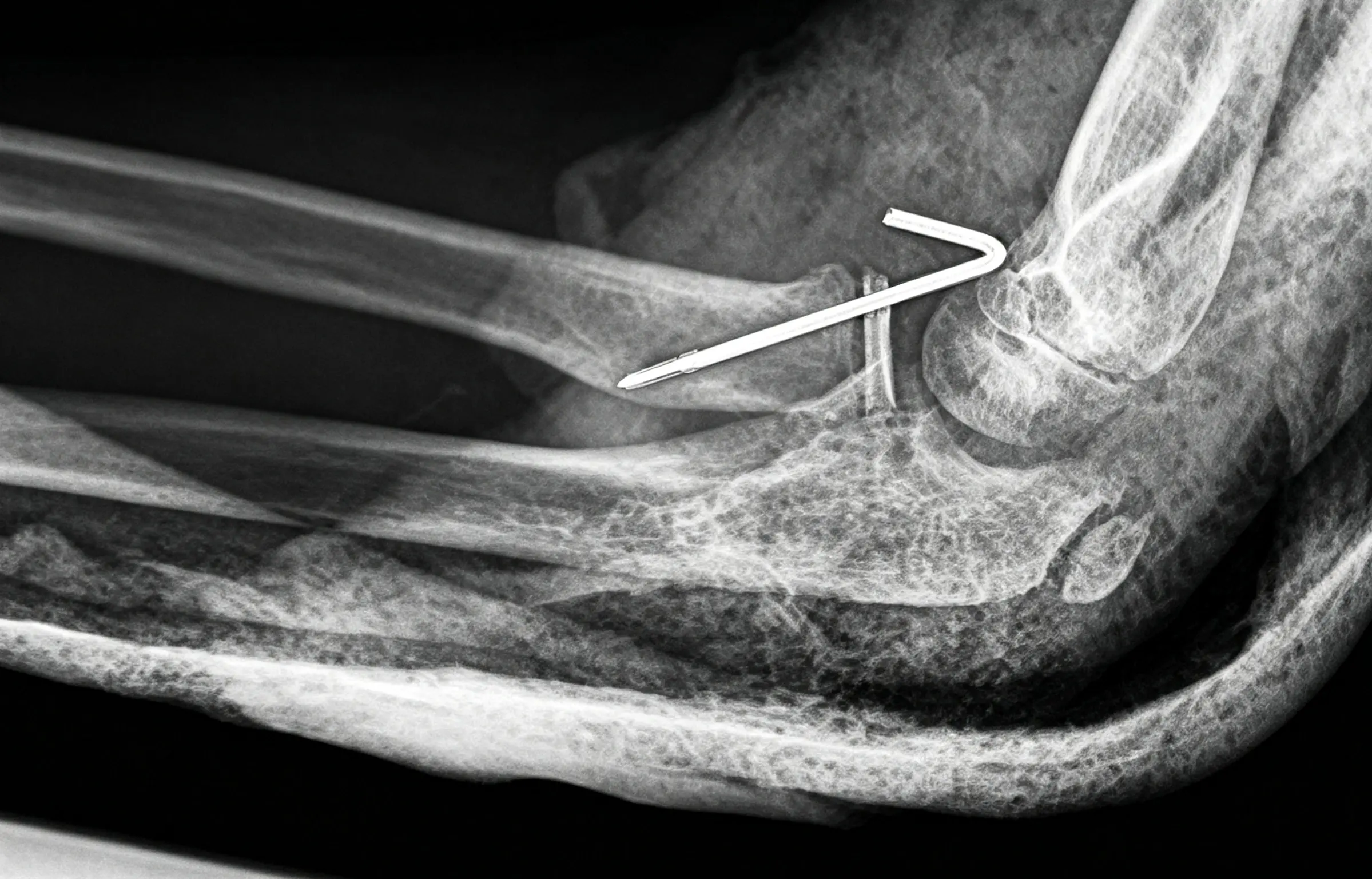 Surgical imaging.webp