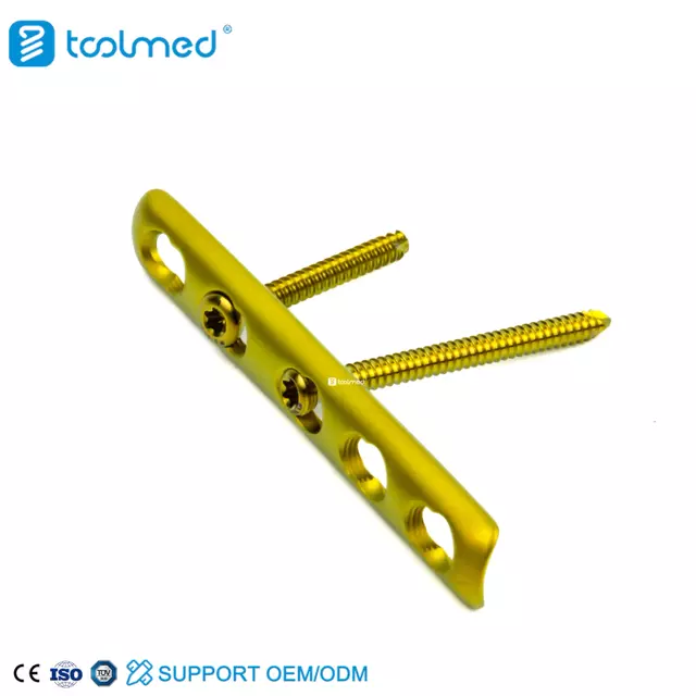 1/3 Tubular Locking Plate