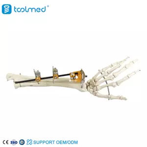 UIna & Radius External Fixator 