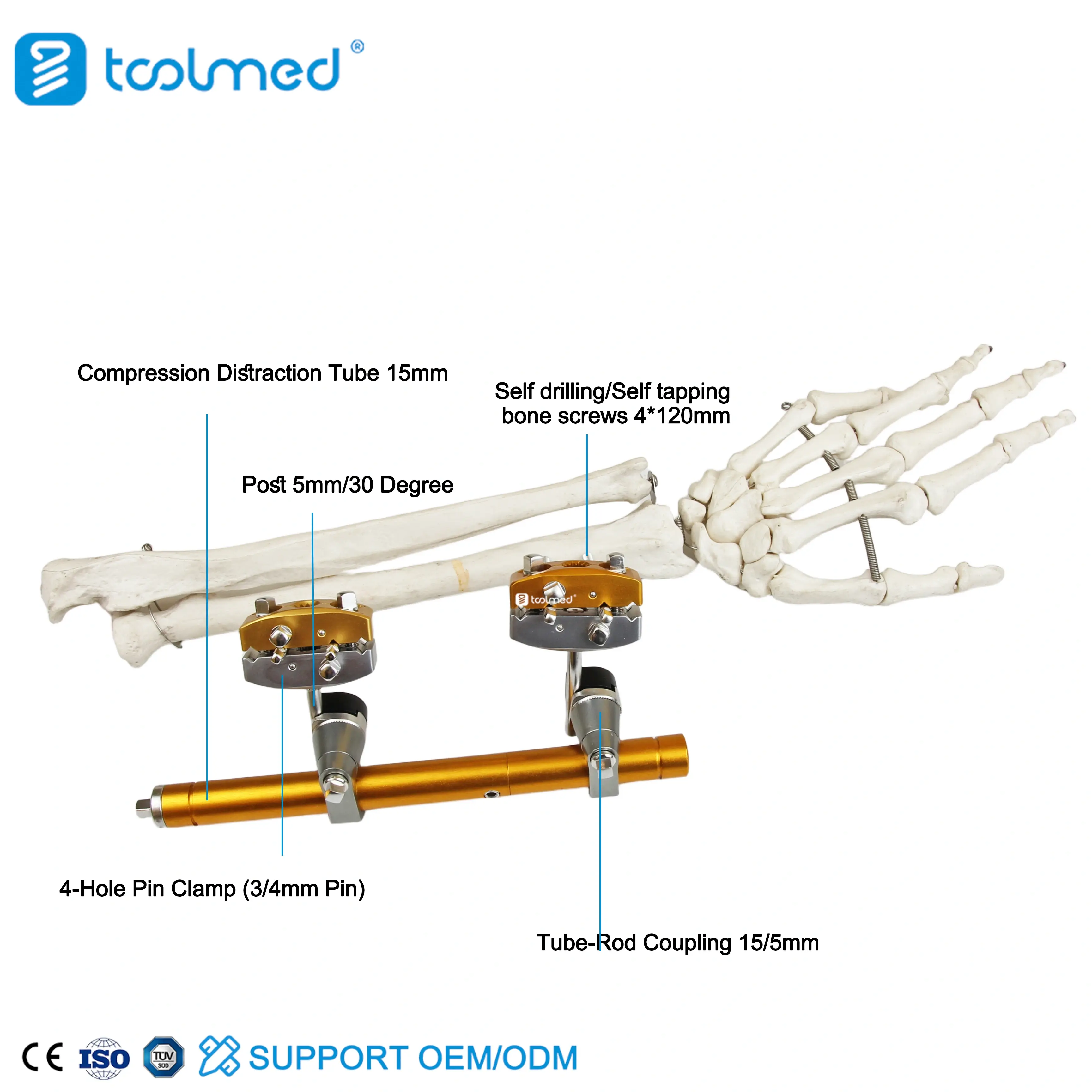 Humeral Shaft External Fixator