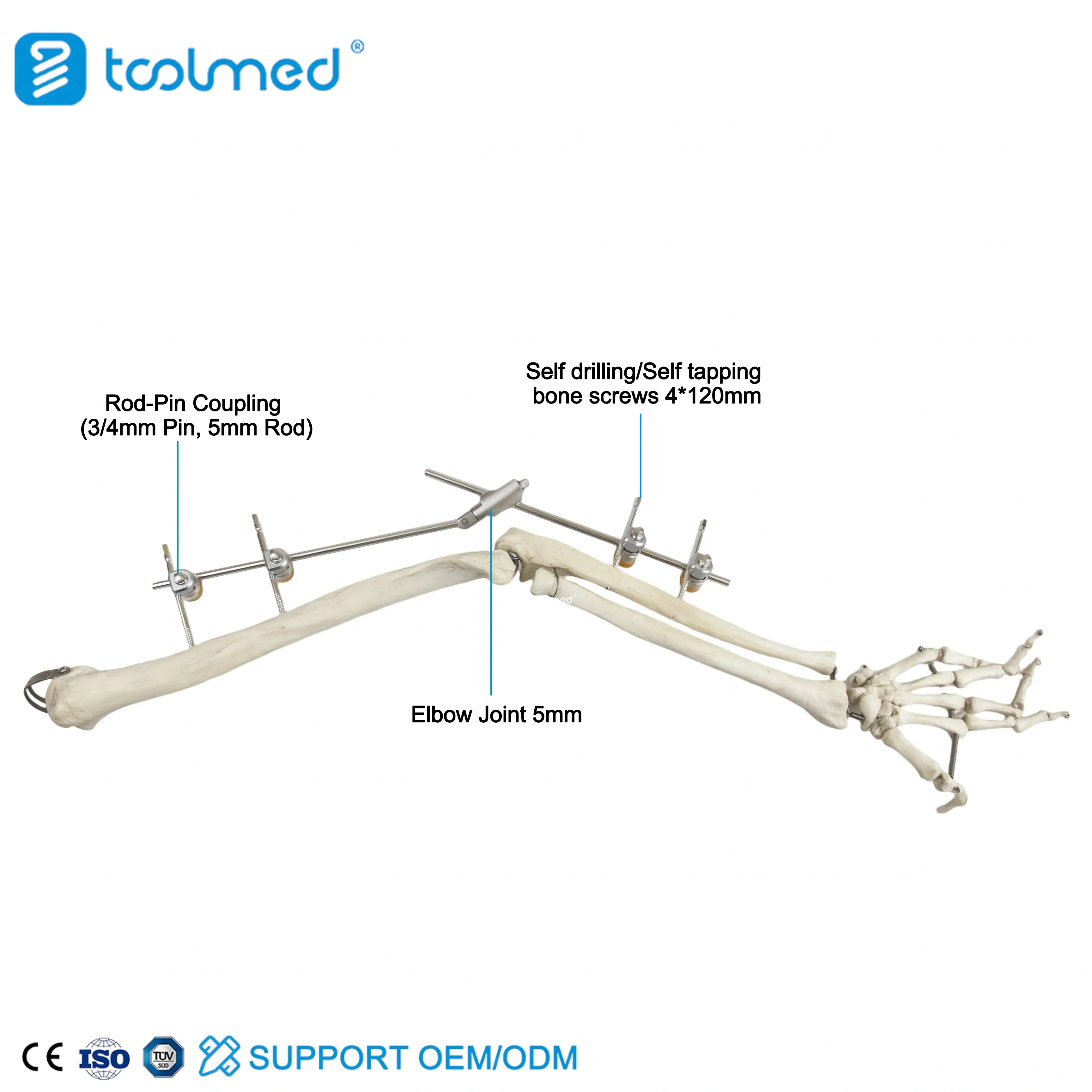 Elbow Joint External Fixator
