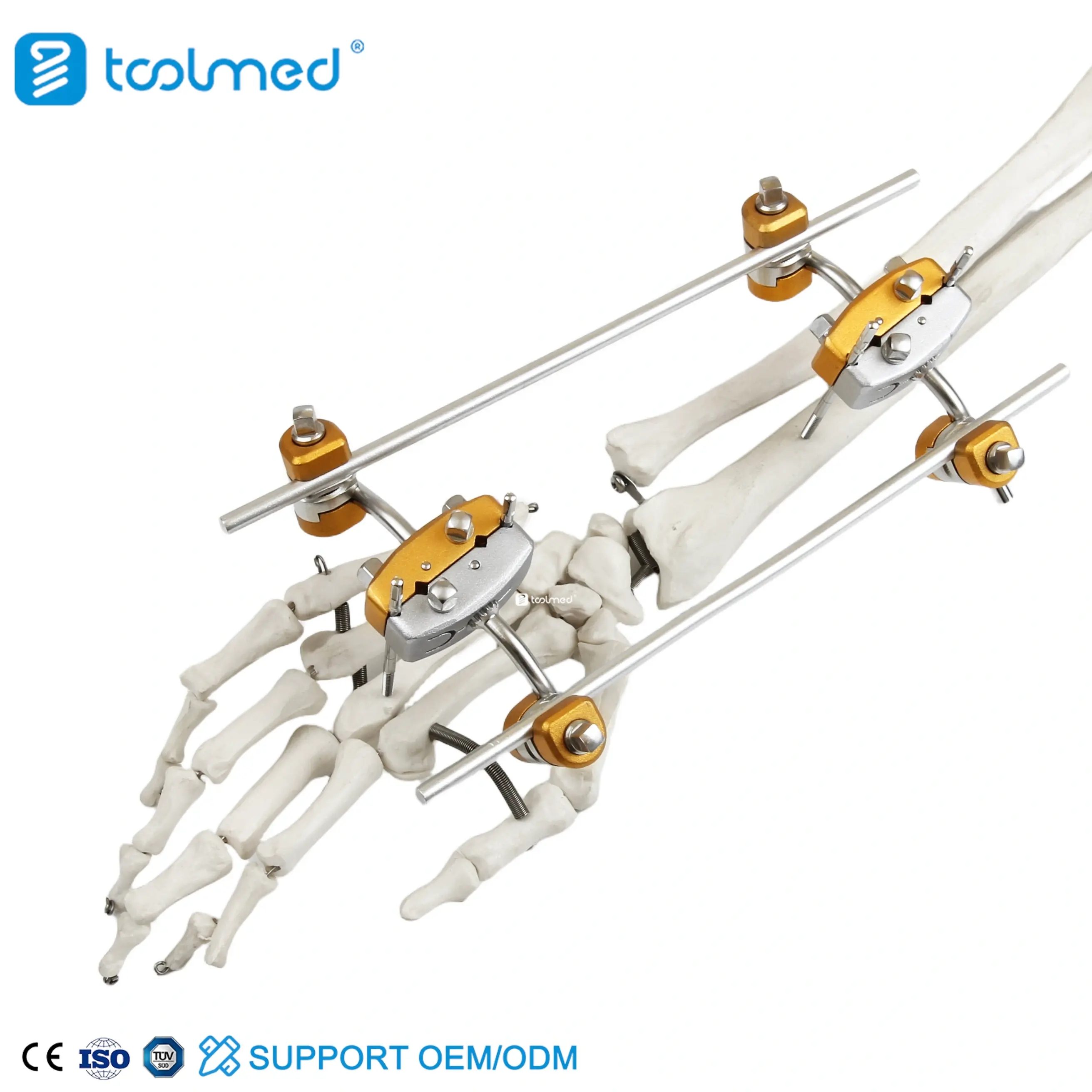 Ulna & Radius External Fixator