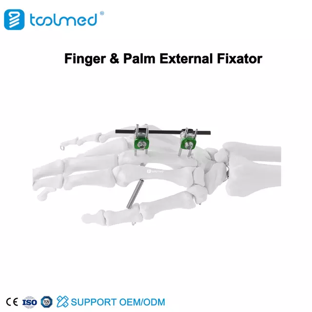 Finger & Palm External Fixator
