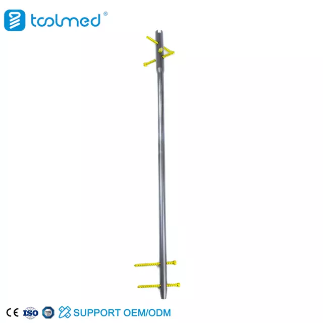 Humeral Intramedullary Nail