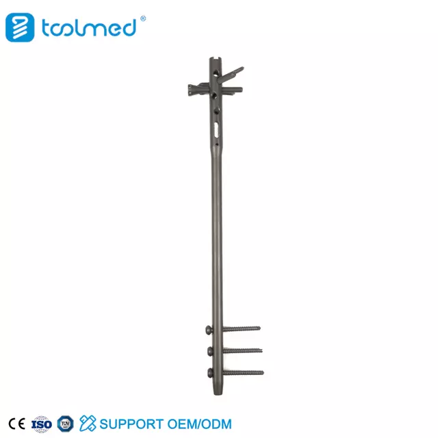 Multi-lock Humeral Intramedullary Nail