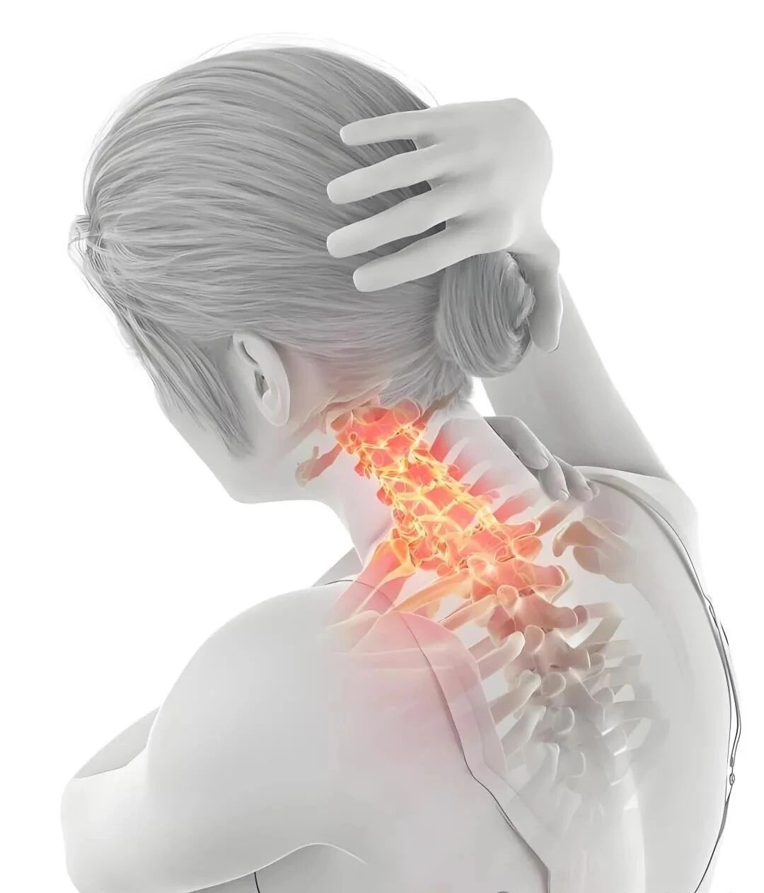Cervical spondylosis