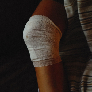 fracture of the inferior pole of the patella.jpg