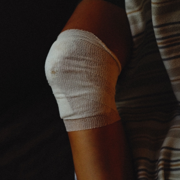 fracture of the inferior pole of the patella.jpg