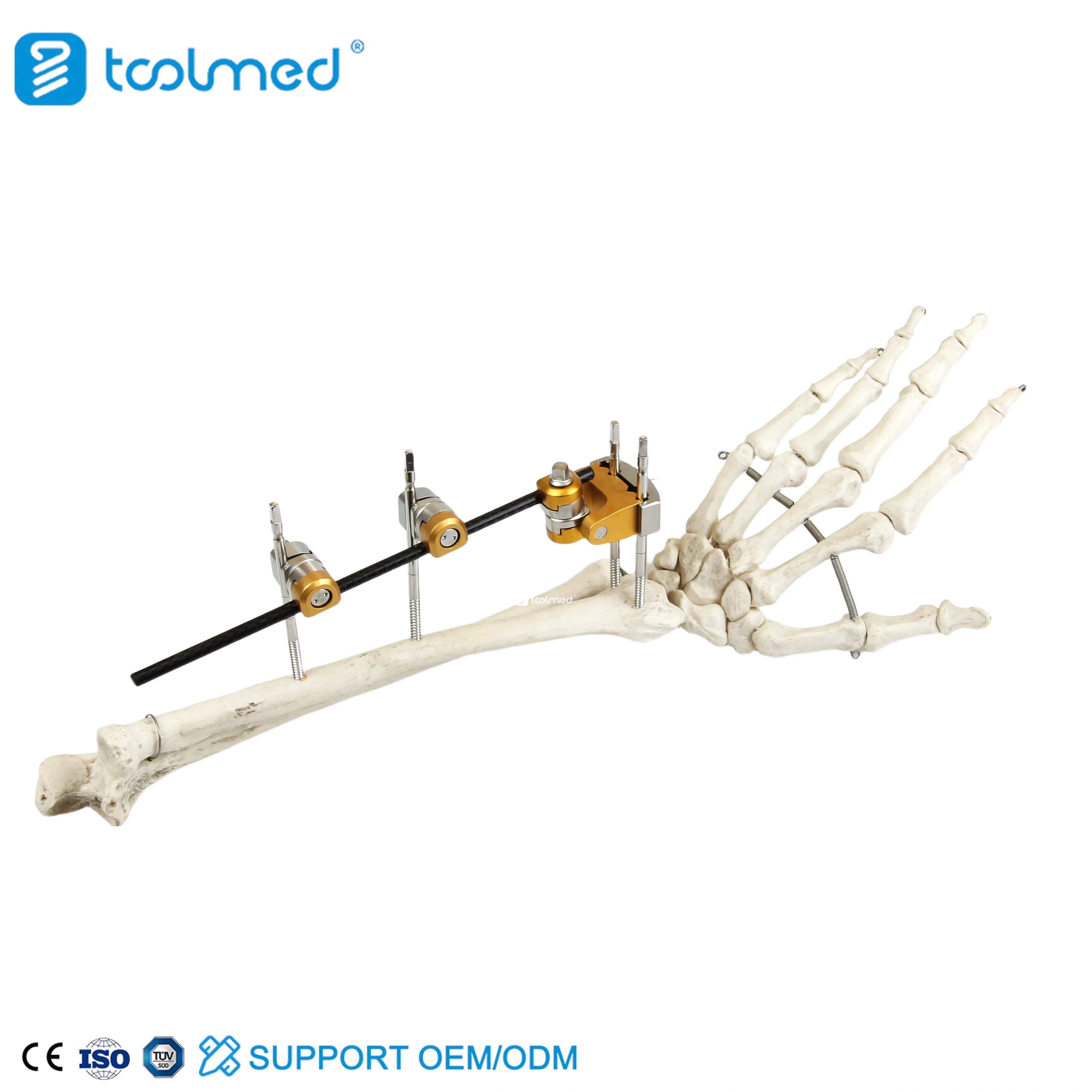 UIna & Radius External Fixator 