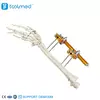 Humeral Shaft External Fixator