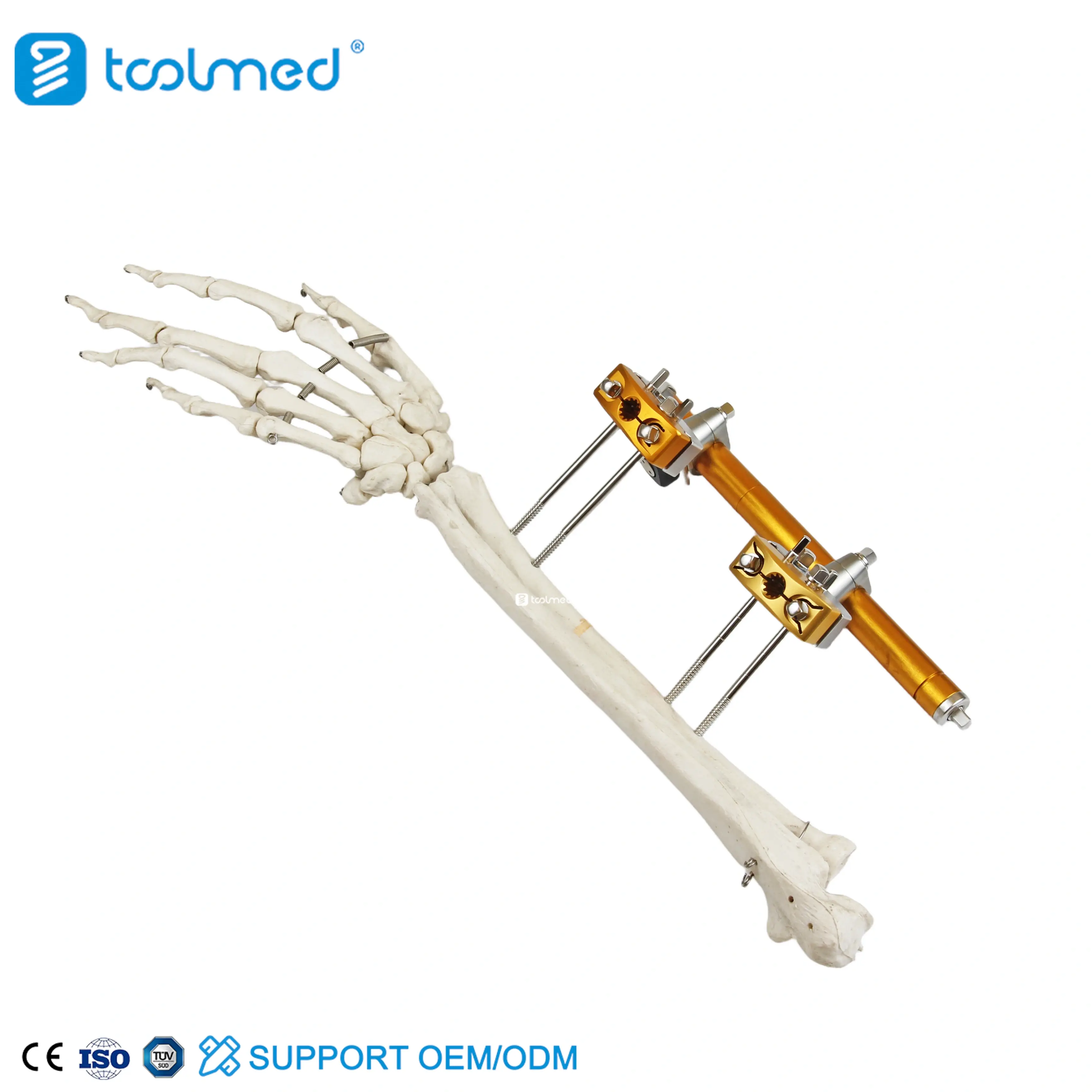 Humeral Shaft External Fixator