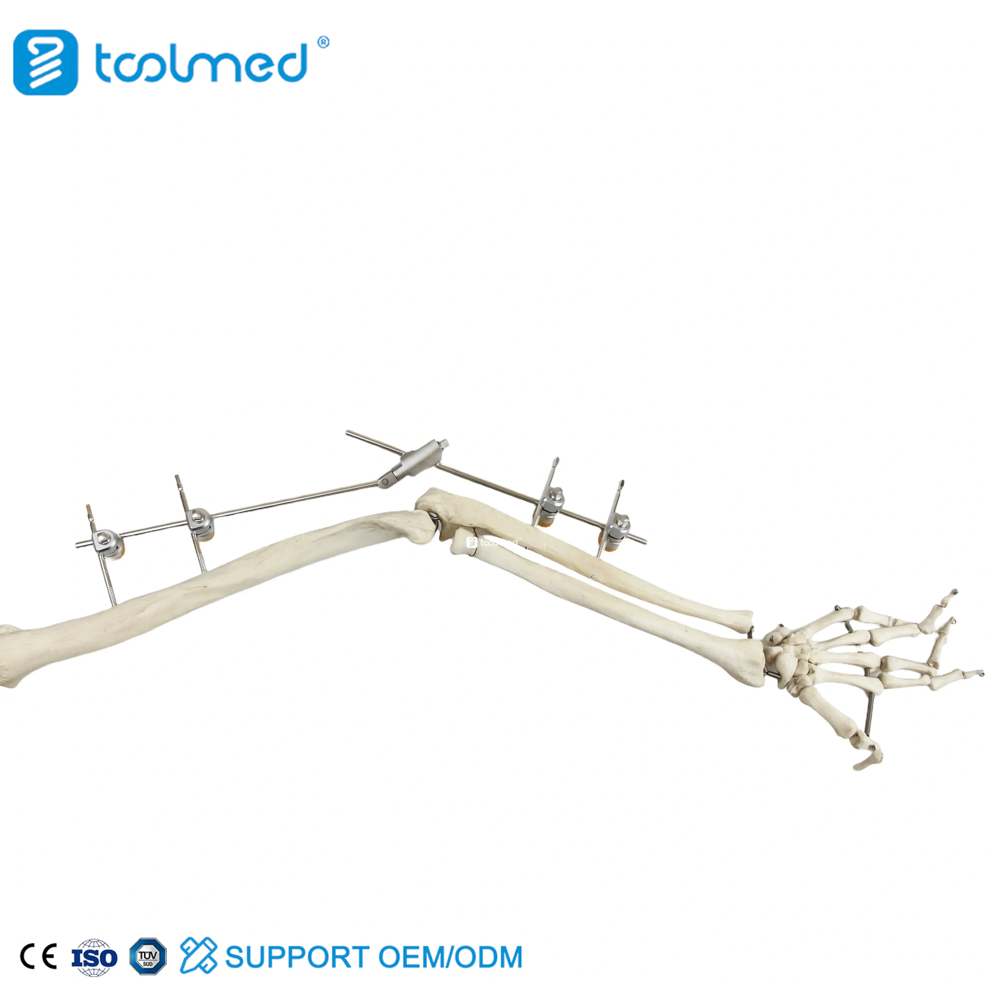 Elbow Joint External Fixator