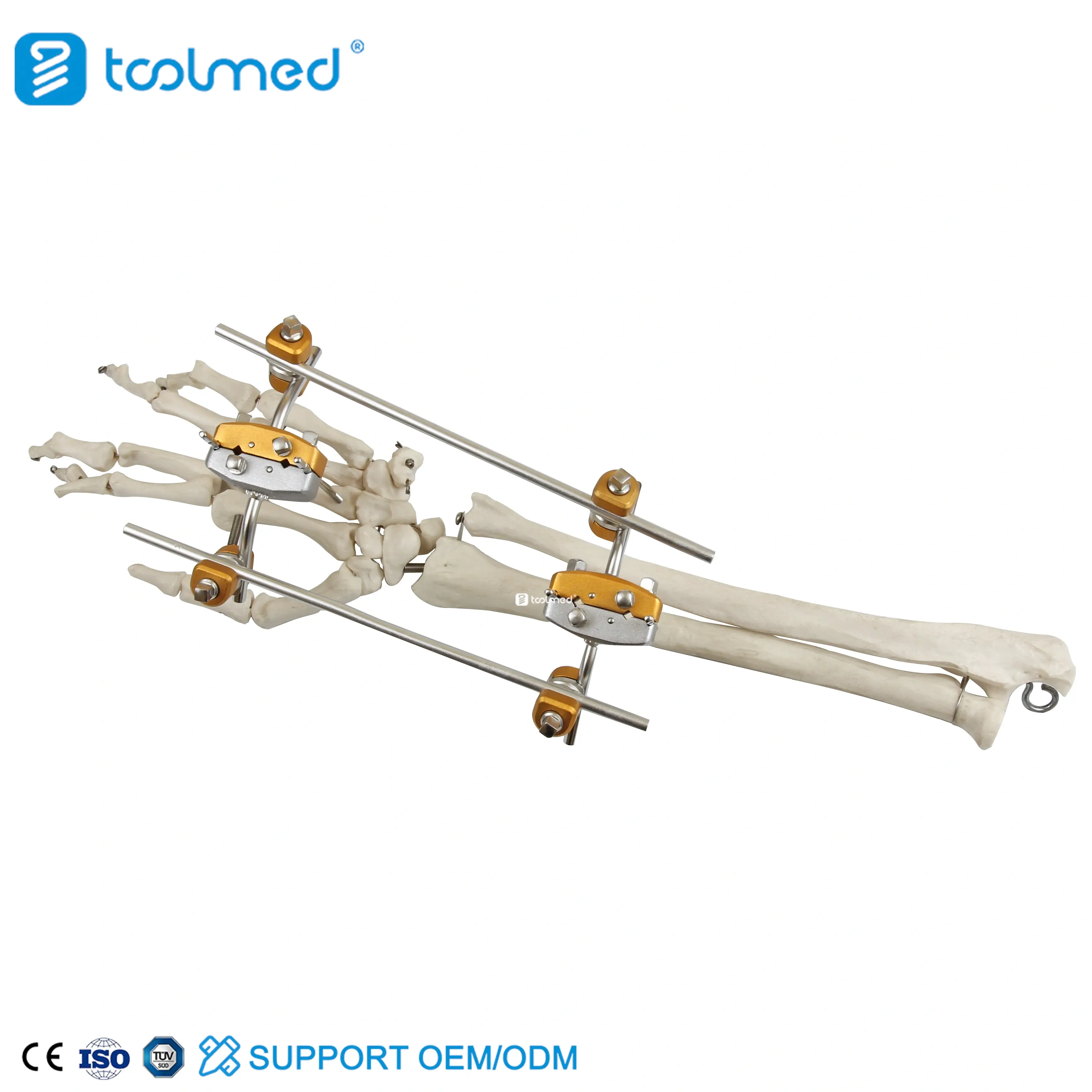 Ulna & Radius External Fixator