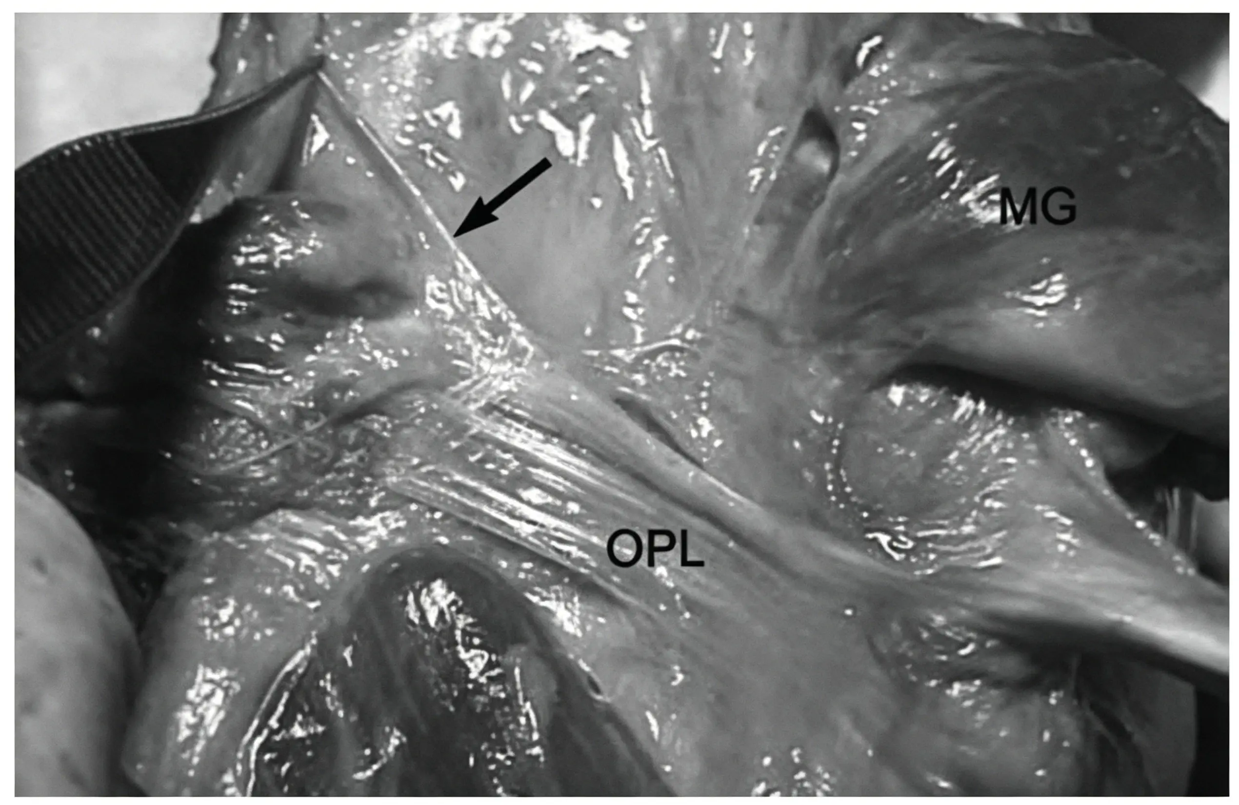 Figure 2. Posterior view of the left knee joint. (1).webp