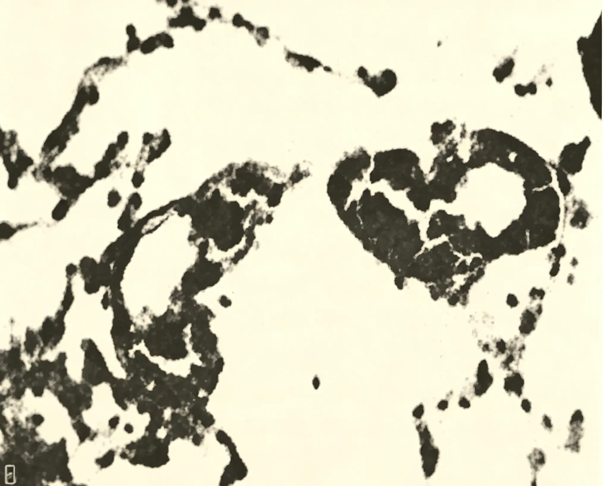 Polymethyl methacrylate particles.webp