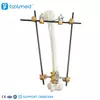 Humeral Shaft External Fixator 5300-10