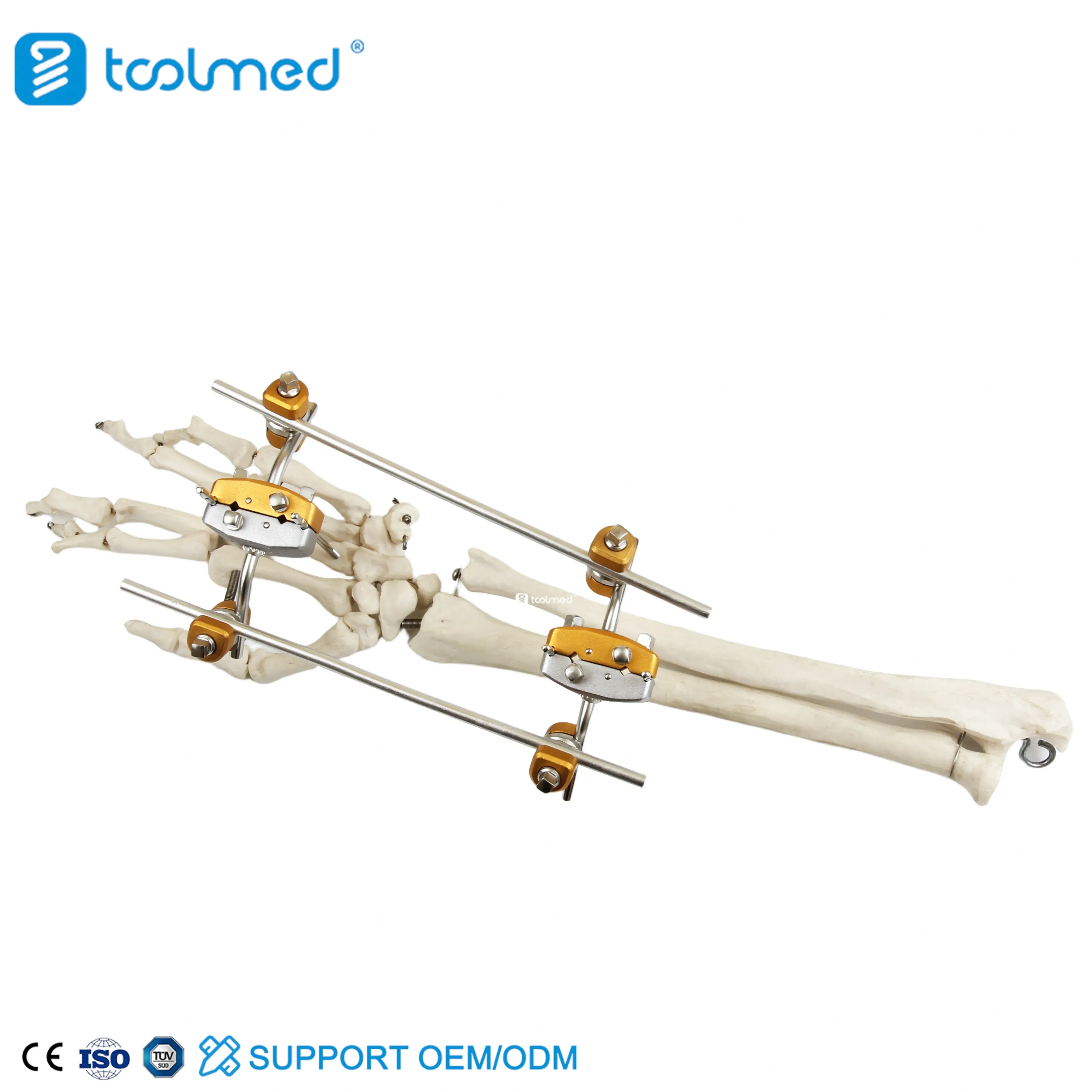 Ulna & Radius External Fixator