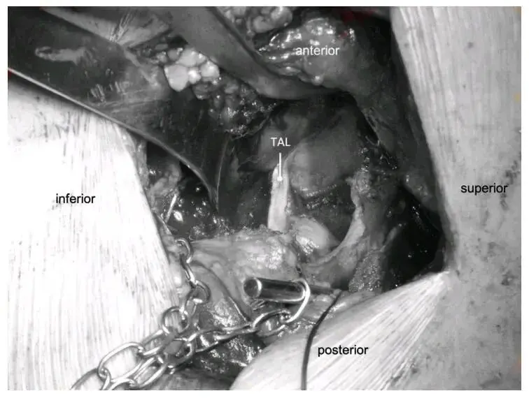 surgical photos.webp