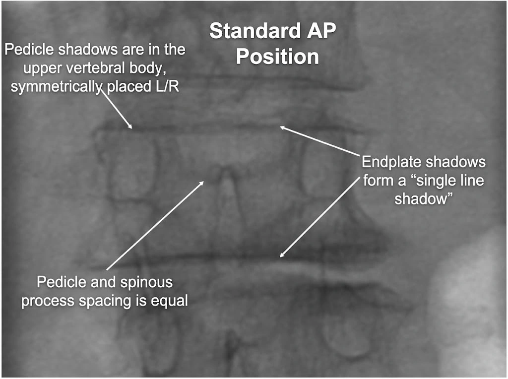 Fluoroscopic localization 1